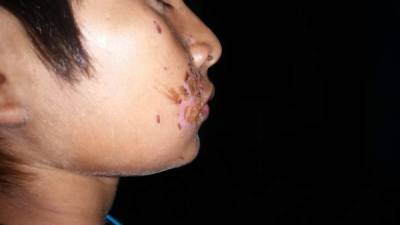 Las autoridades mostraron las quemaduras ocasionadas en la cara del niño.