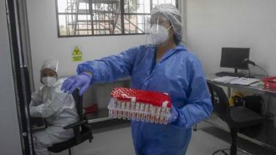 Brasil es actualmente el segundo país de América con más infecciones por viruela del mono.