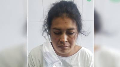 Rosvinda María Alfaro Cruz fue atendida en un centro asistencial.