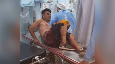 Jose Gonzales, supuesto miembro de la MS, salió herido luego del enfrentamiento entre pandilleros y policías en la colonia Orocuina de Tegucigalpa.