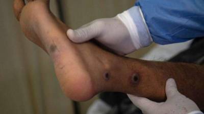 De acuerdo con Roberto Contreras, hasta el lunes se conocerán los resultados.