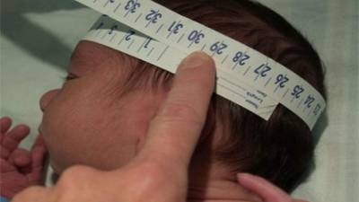 Uno de los mayores peligros para las embarazadas es que sus bebés puedan nacer con defectos congénitos como la microcefalia, si llegan a infectarse con la enfermedad.