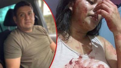 Foto de José Fredy Luna y Lisbany León.