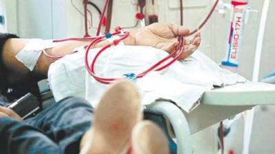 Dietas altas en azúcares y calorías están afectando riñones de adultos jóvenes en Honduras