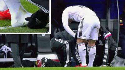 James Rodríguez se lesionó contra el Sevilla. Foto cortesía Marca.com