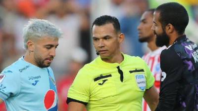 Auzmendi es baja sensible en Motagua para el clásico ante Olimpia.