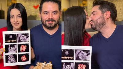 José Eduardo Derbez y su novia Paola Dalay mostraron una ecografía de su bebé.
