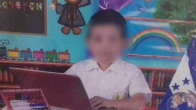 El pequeño Jasiel Leiva murió el martes en El Progreso.