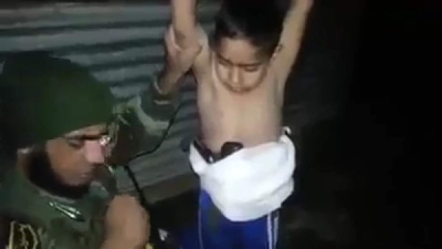 El niño tenía un cinturón con explosivos bajo su camiseta.