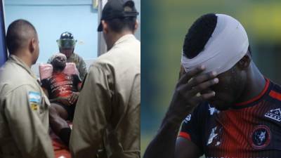 El duelo del pasado sábado entre Parrillas One e Independiente dejó un zafarrancho en la Liga de Ascenso. En las últimas horas se han viralizado fuertes imágenes de las heridas que sufrieron algunos jugadores.