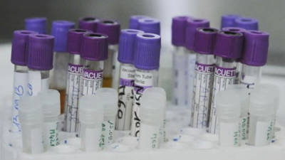 ONUSIDA destaca el avance en el control de infecciones.