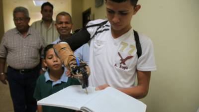 Allan volvió a escribir gracias a prótesis que le colocaron en brigada.