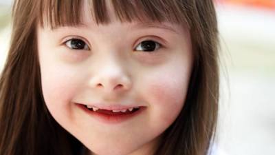 Especialistas lograron neutralizar los genes extras a partir de una terapia que utiliza las células madre