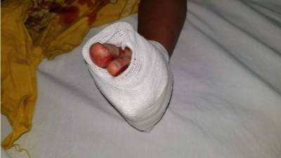 La menor cuando era atendida en un centro asistencial.