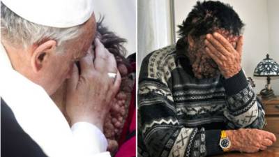 Vinicio protagonizó una de las imágenes más impactantes de este pontificado.