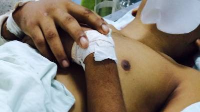 Foto del joven proporcionada por el Hospital Escuela Universitario (HEU).