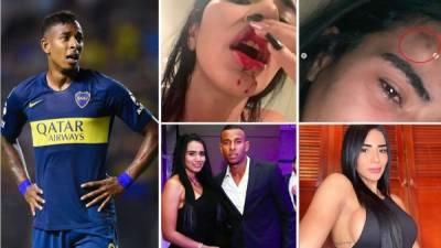 Sebastián Villa, delantero colombiano de Boca Juniors, fue denunciado por su novia Daniela Cortés por violencia de género a través de una publicación en su cuenta de Instagram, en la que lo acusó de “maltratador físico y psicológico” y mostró fotos y videos de las lesiones que le habría provocado el futbolista.