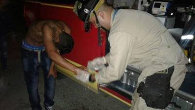 Al joven (de 17 años) le explotó un mortero en la mano, esto fue en Choloma. Foto: Bomberos