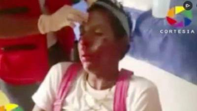 Tras la golpiza, el payaso fue atendido por paramédicos de la Cruz Roja.