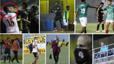 Las imágenes más curosas y llamativas que dejó la primera jornada del Torneo Clausura 2021 de la Liga Nacional de Honduras.