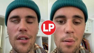 El lado derecho del rostro del popular cantante Justin Bieber está paralizado a causa de un virus.