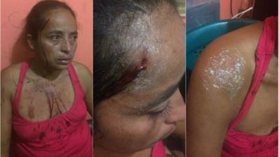 La mujer agredida se refugió en la casa algunos vecinos.