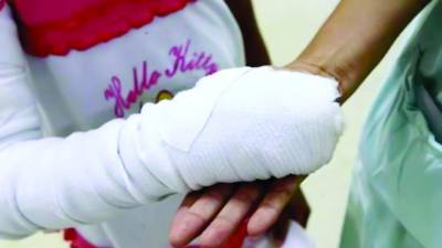 <b>Una niña con quemadura por pólvora es atendida en el hospital Mario Rivas. Foto: LA PRENSA</b>