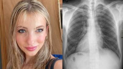 Claire Mack contó de su extraña condición a sus seguidores en la red social TikTok.