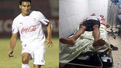Mariano Acevedo, ex jugador del Olimpia, está hospitalizado desde el jueves.