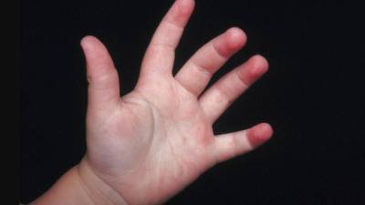 8,000 menores tiene Dinaf bajo custodia, institucionalizados en 80 casas hogar y familias de protección temporal.