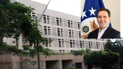 Lawrence J. Gumbiner, encargado de negocios de la embajada.