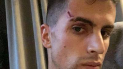 Joao Cancelo fue golpeado por los delincuentes que ingresaron a su habitación.