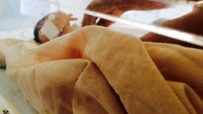 Foto proporcionada por el Hospital Escuela Universitario (HEU).