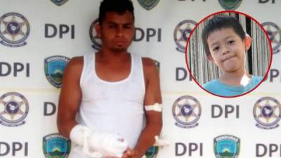 Vendado por las heridas que recibió durante el altercado que tuvo con el padre de la víctima, fue presentado ayer por la Policía Selvin Reynieri Hernández.