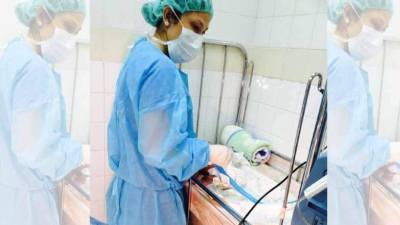 Imágenes de un bebé con microcefalia cuando estaba con vida en el Hospital Escuela.