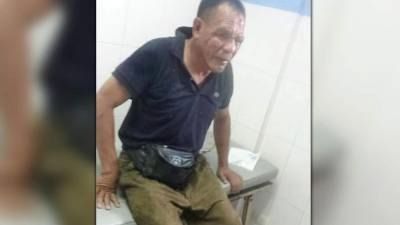 Óscar Guevara fue llevado al hospital Mario Rivas.