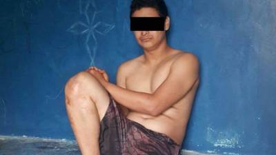 El adolescente ya está en el Centro Pedagógico El Carmen de San Pedro Sula.