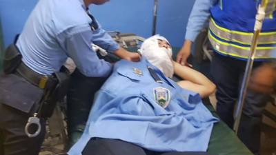 Un agente de la Policía Nacional es atendido después de que lanzaran sobre él una sustancia química.