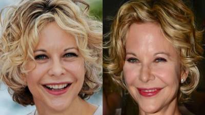 El antes y después del Meg Ryan.