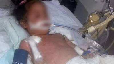 Dayana tiene más de una semana de estar en Cuidados Intensivos en el Seguro Social y su única esperanza es el trasplante.