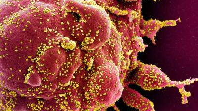 Esta imagen de folleto obtenida el 29 de abril de 2020 y publicada por el Instituto Nacional de Alergias y Enfermedades Infecciosas (NIAID) de los Institutos Nacionales de Salud (NIH), muestra una micrografía electrónica de exploración coloreada de una célula apoptótica (roja) muy infectada con el SARS -Partículas de virus COV-2 (amarillo), aisladas de una muestra de paciente capturada en el Centro de Investigación Integrada (IRF) del NIAID en Fort Detrick, Maryland.