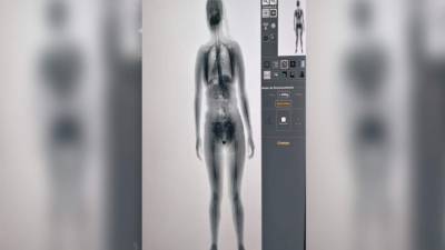 Autoridades detectaron la supuesta droga mediante rayos x.