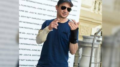 Jeremy Renner muestra sus brazos fracturados.