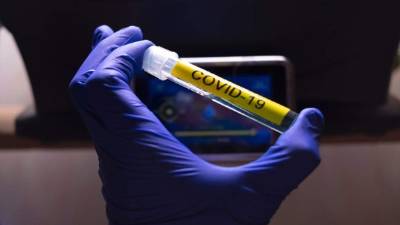 Pese a meses de investigaciones, sigue sin saberse con exactitud el origen del virus, si bien se considera que fue transmitido desde animales.