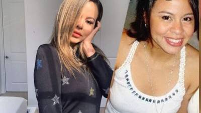 Al parecer la hondureña Ana Alvarado sucumbió a la presión de la 'perfección' que predican muchos influencer en Instagram.La catracha recurrió a las cirugías plásticas para mejorar su aspecto físico no con uno sino con tres procedimientos estéticos, y estos solo son los más recientes.