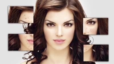 Cualquiera que sea tu tipo de acné lo ideal es no tocar las lesiones. Busca la orientación de un dermatólogo.