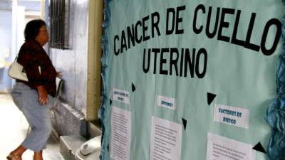 La Liga contra el Cáncer promueve la práctica de la citología cervicovaginal para prevenir la enfermedad.
