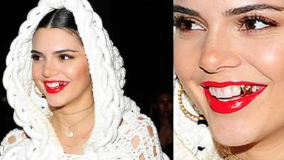 La nueva sonrisa de Kendall robó miradas.