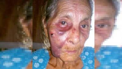 La señora quedó severamente golpeada.