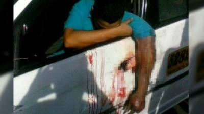 El conductor no soportaba el dolor de su terrible fractura.